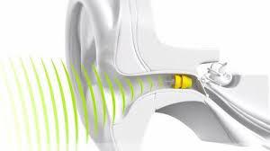 Lyric invisible, extended-wear hearing aid