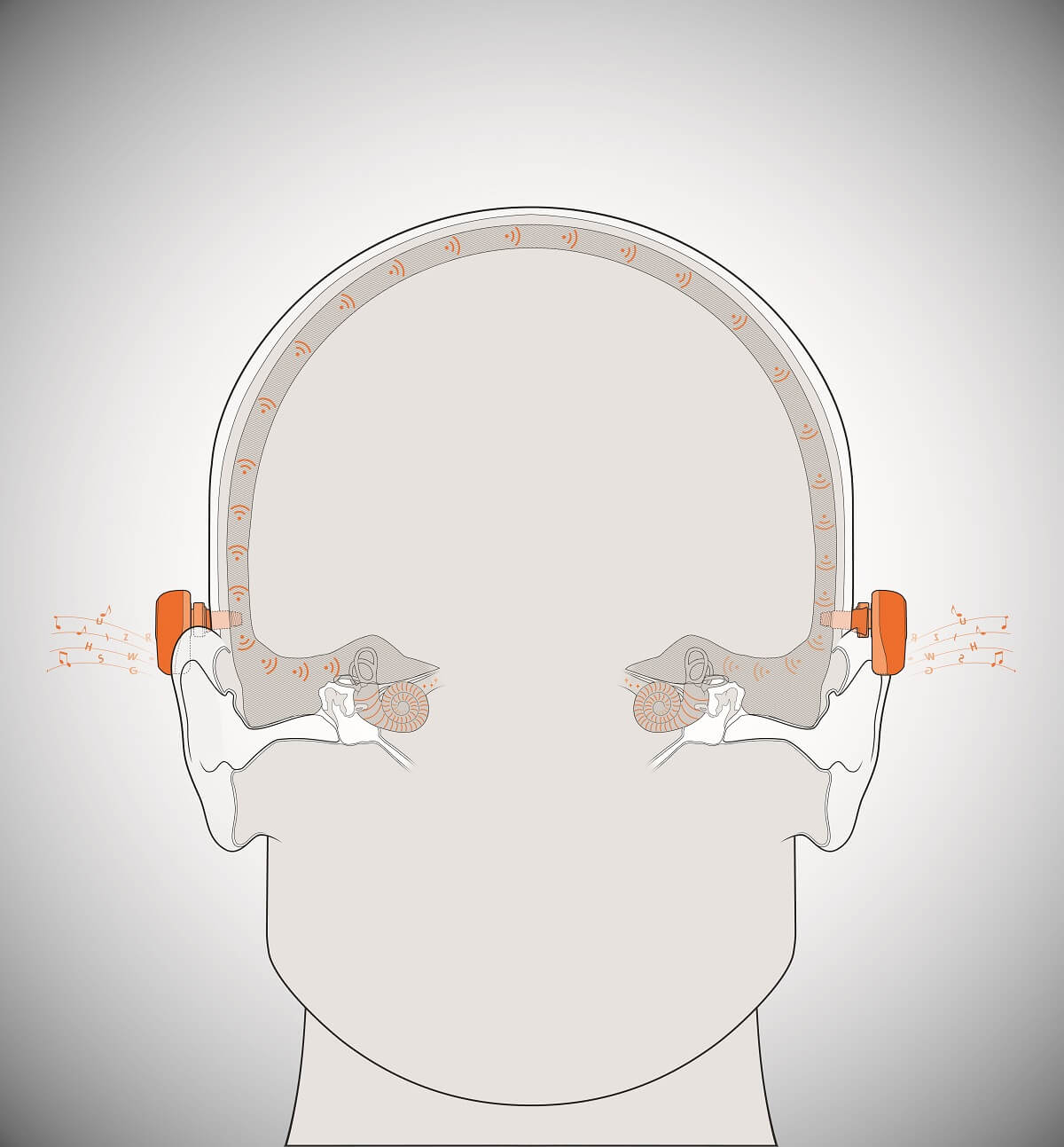 depiction of sound transmitting from the BAHS to the inner ear