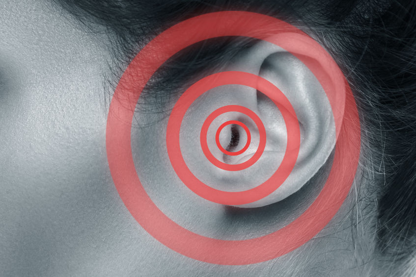 Does Tinnitus Affect the Brain?