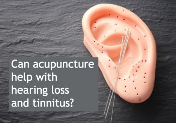 Ear with acupuncture needles