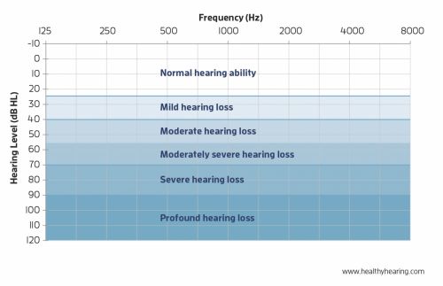 Degrees of hearing loss on an audiogram