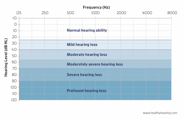 Level Of Hearing Loss Chart