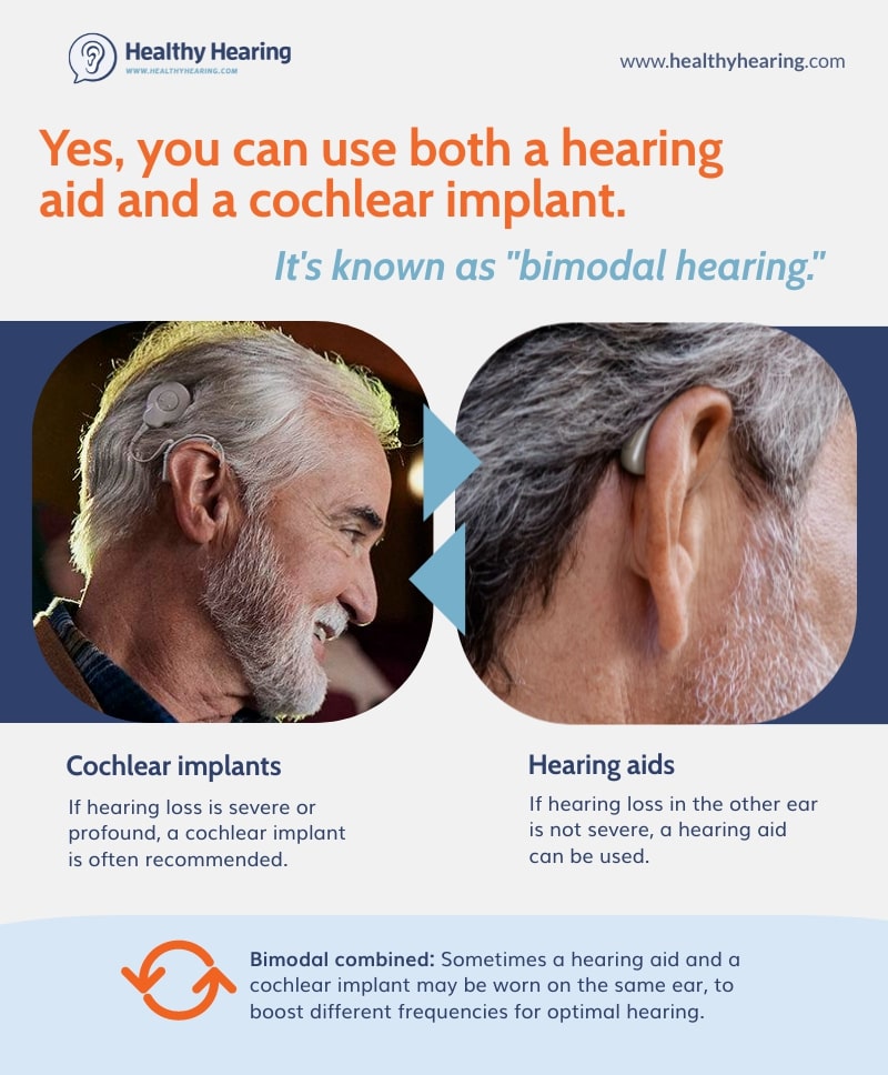 An infographic showing the visual appearnce of cochlear implants vs hearing aids. 