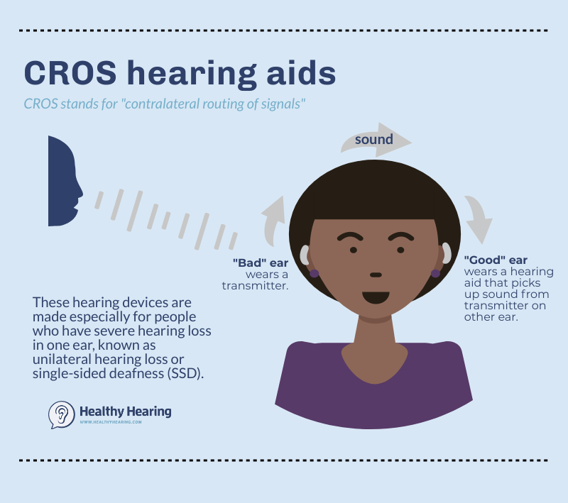 Illustration showing how CROS hearing aids deliver sound from a deaf ear to a hearing ear. 