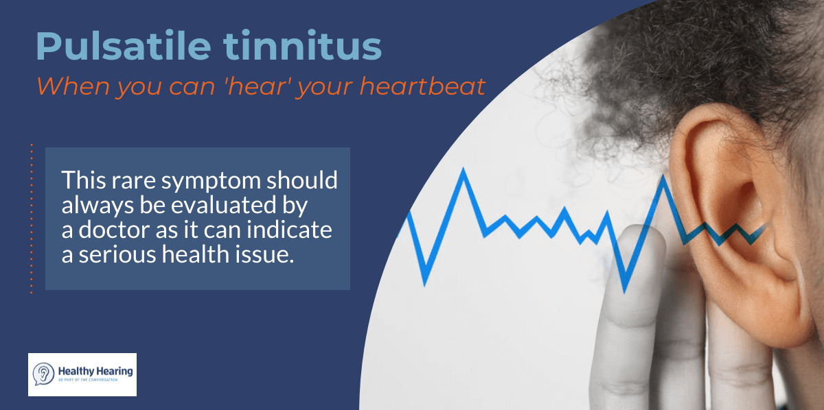 What is pulsatile tinnitus?
