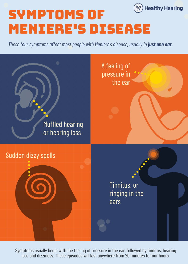 Darmen Onderdrukken Tropisch Ménière's disease - A tricky-to-diagnose inner ear disorder