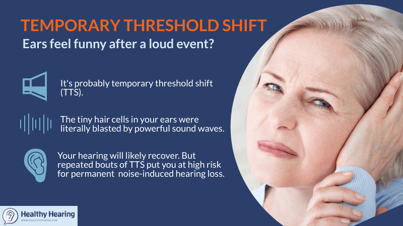 loyaliteit lening pensioen Temporary threshold shift - what it is and why it happens