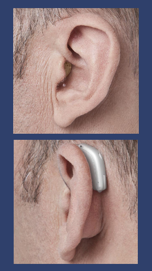 Doct Ear